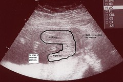 womb 2.2